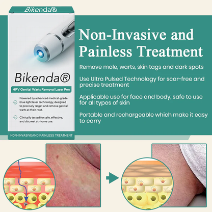 Bikenda® HPV Genital Warts Removal Laser Pen
