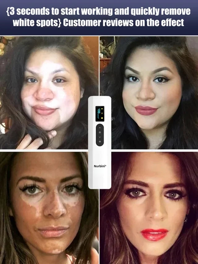Simple At-Home Treatment⏳Limited-time 50% off⏰💥