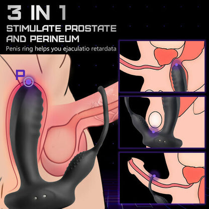 10 Vibrating Smart Heated Multifunctional Prostate Massager with Dual Cock Rings